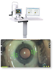VERION　image guidance system
